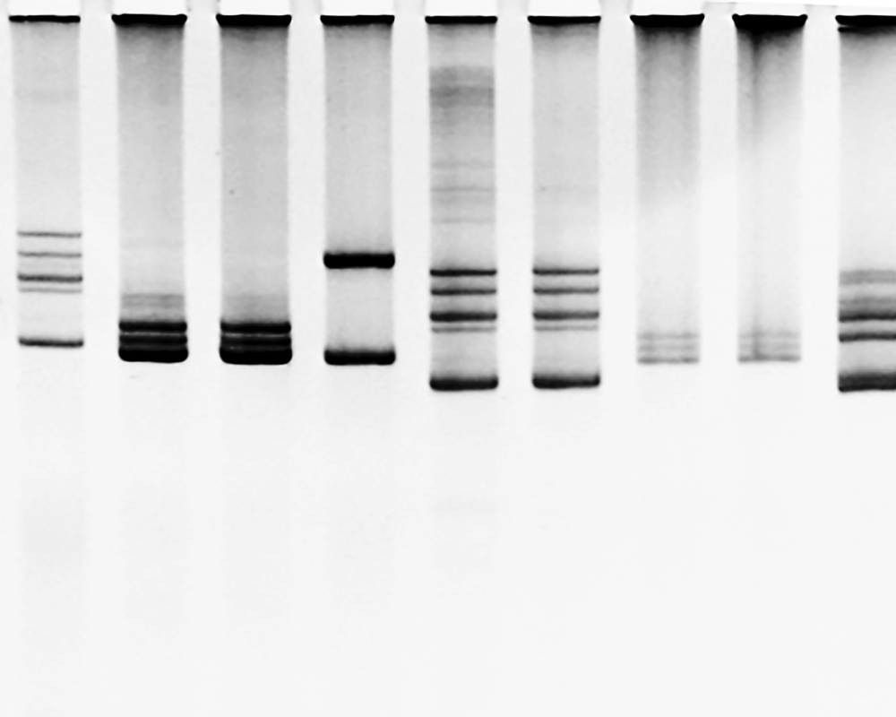 CCD imaging for Western Blot detection